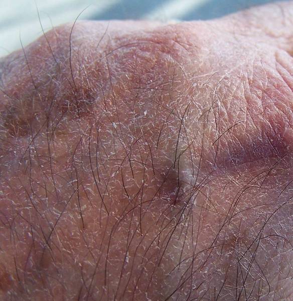 [Image: skinaSM.jpg]